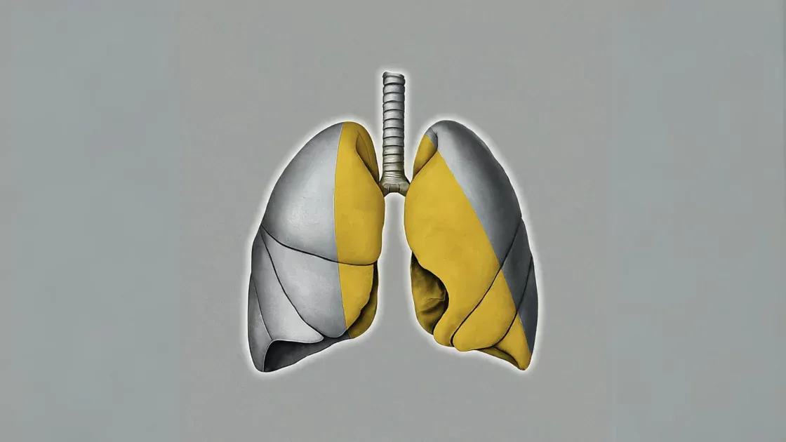 The Importance of Cough in Idiopathic Pulmonary Fibrosis